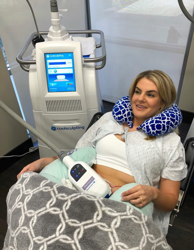 During the Coolsculpting treatment with the applicator on
