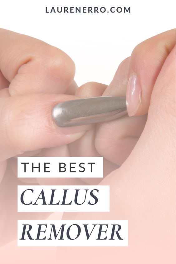 the best callus remover
