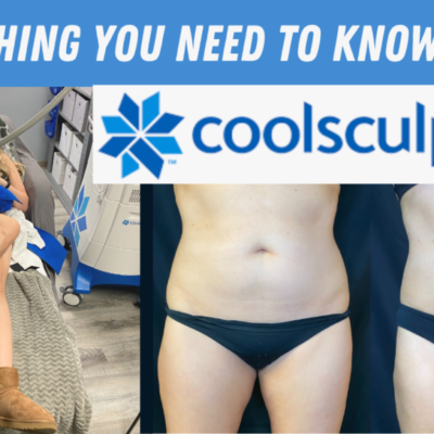 Coolsculpting… Is one treatment enough?